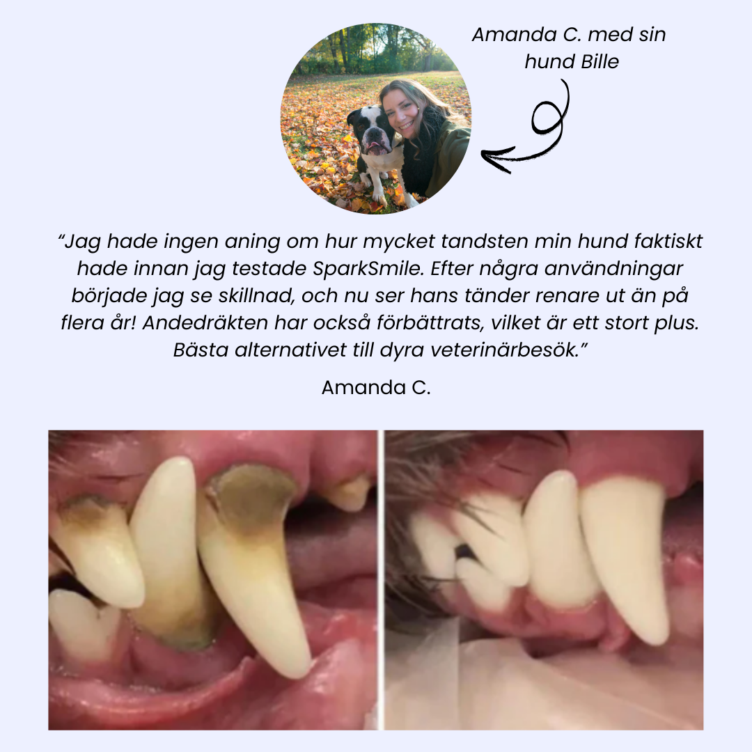 SparkSmile - Tar bort plack och tandsten